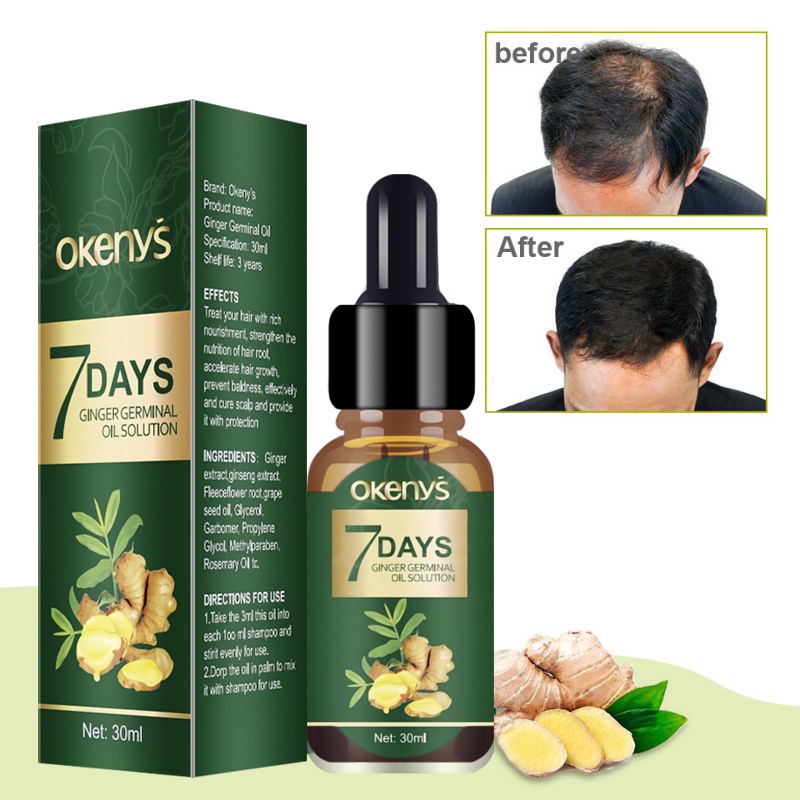 Ginger Hair growth Essence Hair AntiLose Essential Oil Hair Repair
