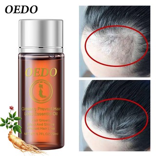 OEDO Ginseng Hair Growth Essence Preventing Hair Loss Liquid Damage Hair Repair Treatment Dense Fast Restoration Hair Growth 20ml
