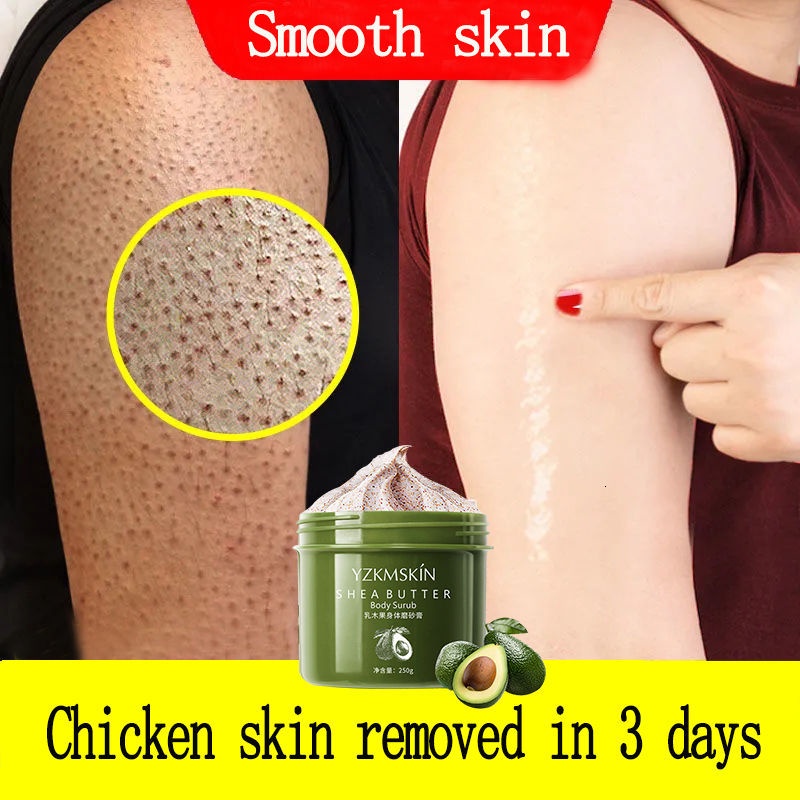 Niacinamide Shea Butter Body Scrub Chicken Skin Removal Dead Skin Remover Exfoliating Make Skin