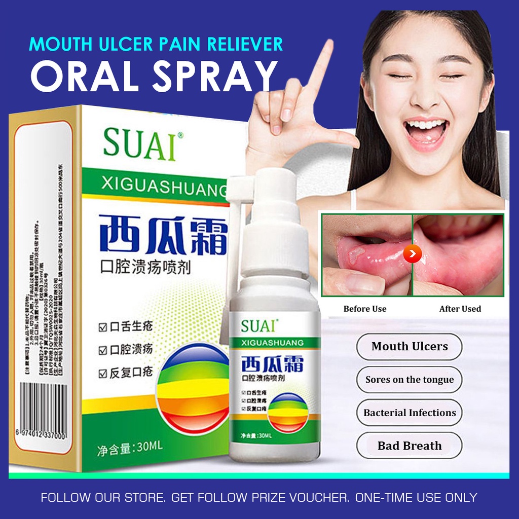 30ml Mouth Ulcer Oral Spray Pain Reliever Watermelon Cream Anti
