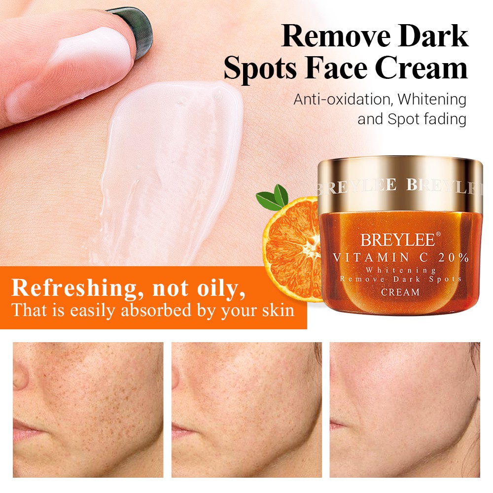 moisturizer to remove dark spots