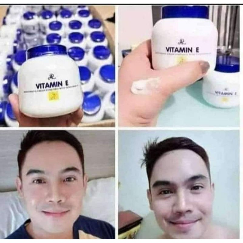 vitamin e cream for hyperpigmentation