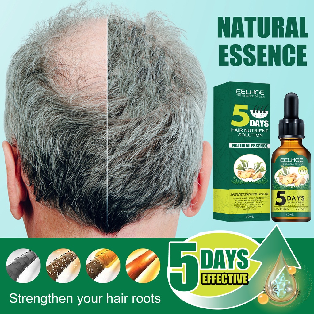Ginger Hair Growth Hair Grower Serum Oil Liquid Growth Liquid Anti-Hair Loss  Essential Oil Hair Care | Shopee Philippines
