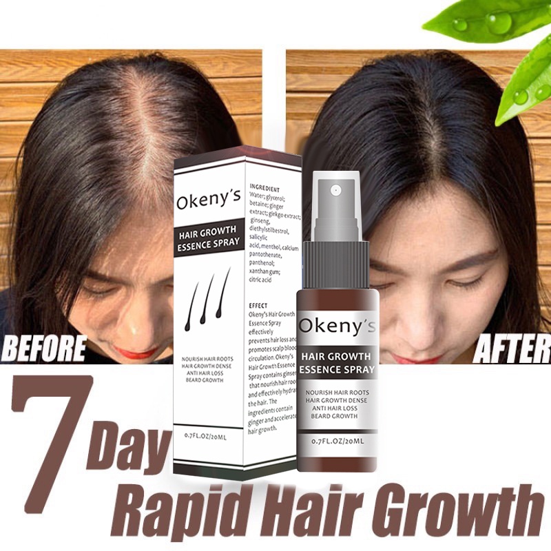 hair growth shampoo spray growniella serum for men goyee hair care set novo scalp treatment loss