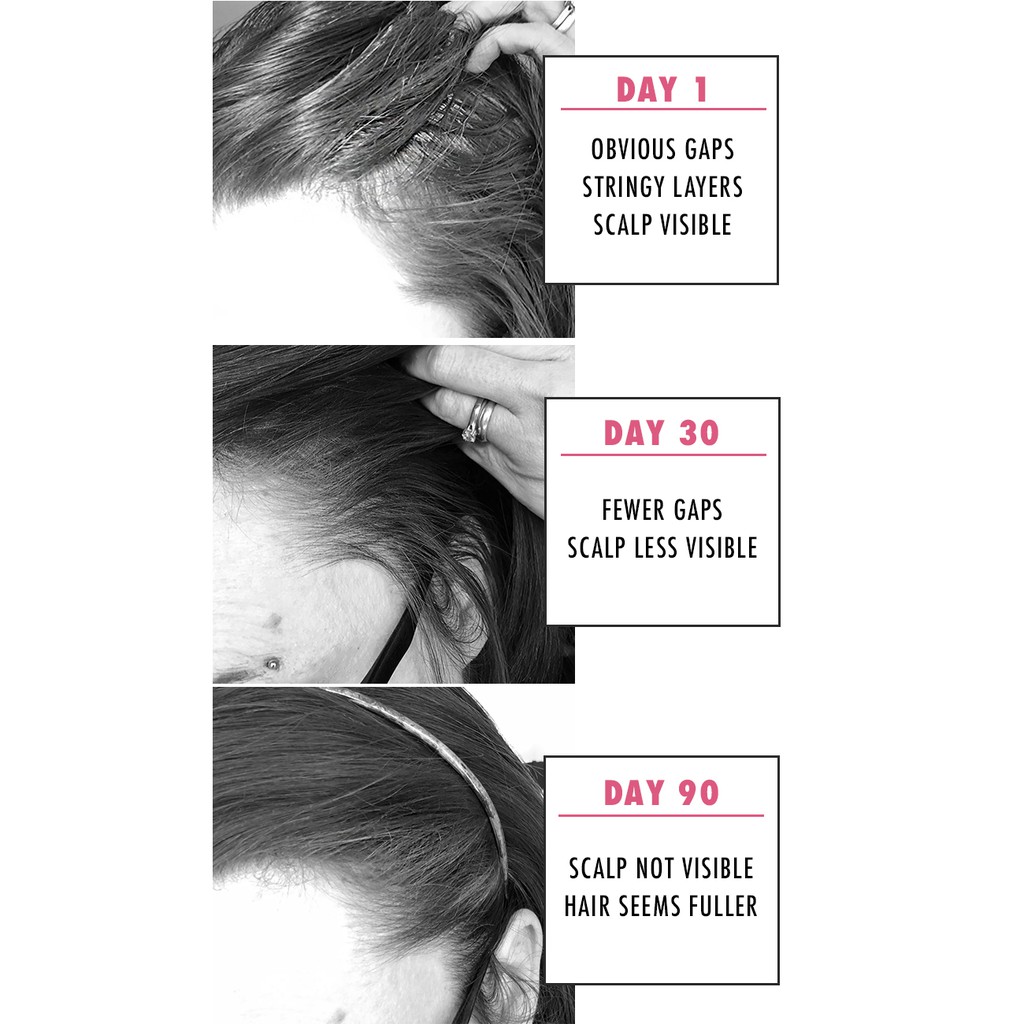 Nioxin 2 Scalps Hair Growth Serum Hair Loss Treatment Thicker Hair Loss  Treatment | Shopee Philippines