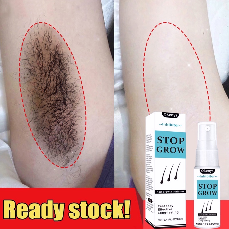 Hair removal spray quick and gentle body hair removal Inhibit hair growth  removal pubic hair 20ml | Shopee Philippines