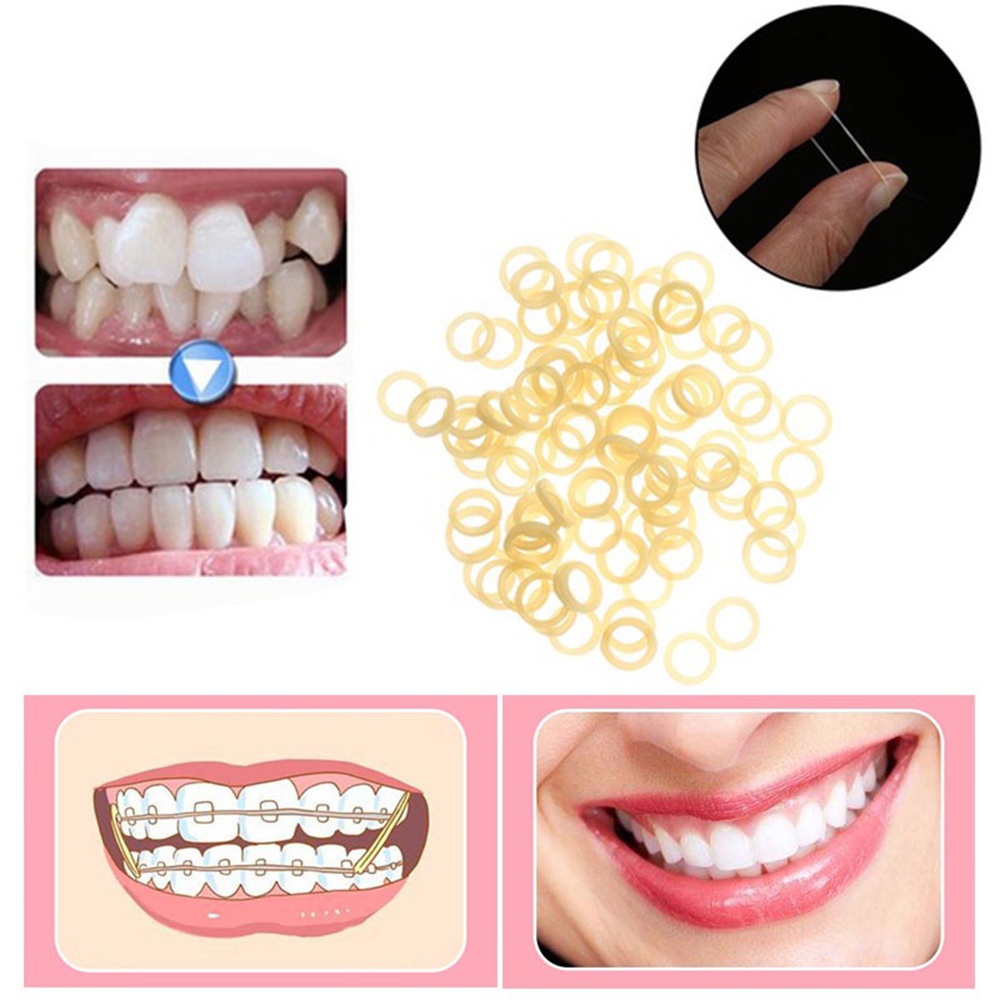 Teeth Gap Dental Rubber Bands Rubber Latex Rings Elastics lOrthodontic