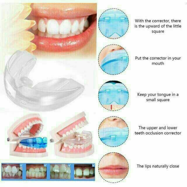 Silicon straightening teeth braces retainer Shopee Philippines