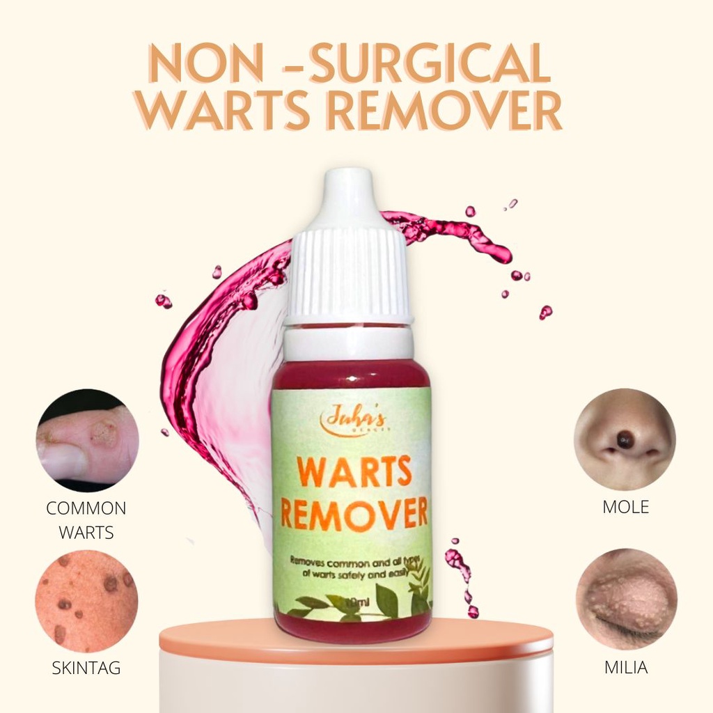 Effective Pure Kasoy Oil Warts Remover Mole Millia Syringoma Skintag Kulugo Genital Warts