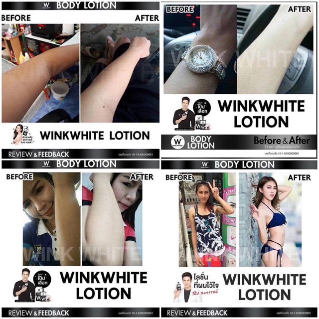 wink lotion