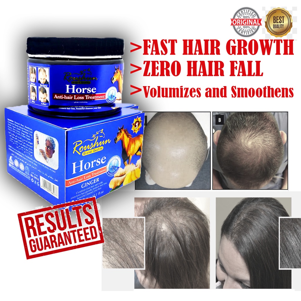 HORSE OIL HAIR GROWER OLIVES Anti hair Loss Fall Thickening Growth mask  treatment Pampakapal Buhok | Shopee Philippines