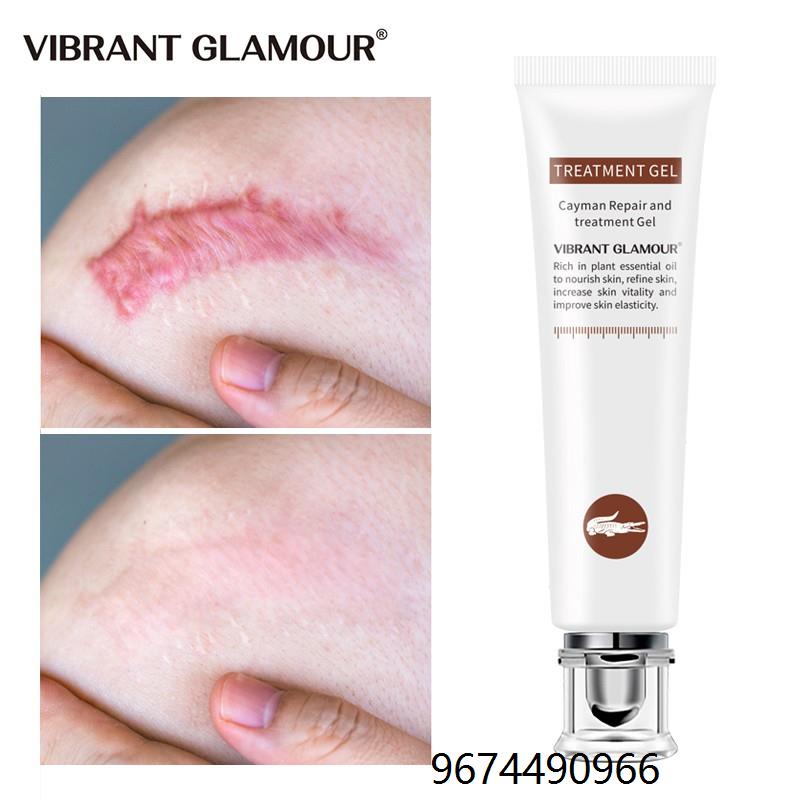 Scar Remover Cream Scars Repair Stretch Marks Pregnancy Scars Scalded
