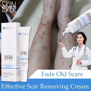 Keloid Remover Scar Removal Scar Cream Scar Treatment Gel Effective Old Scar Remover Skin Care 30g