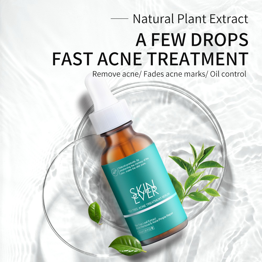 Skin Ever Tea Tree Acne Treatment Serum Anti Acne Oil Control Original Essence Cruelty Free Repair Pimple 30ml | Shopee Philippines