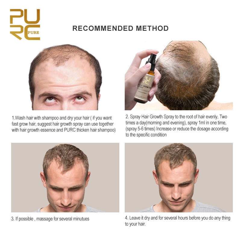 New 30ml Purc Hair Growth Spray Extract Prevent Hair Loss