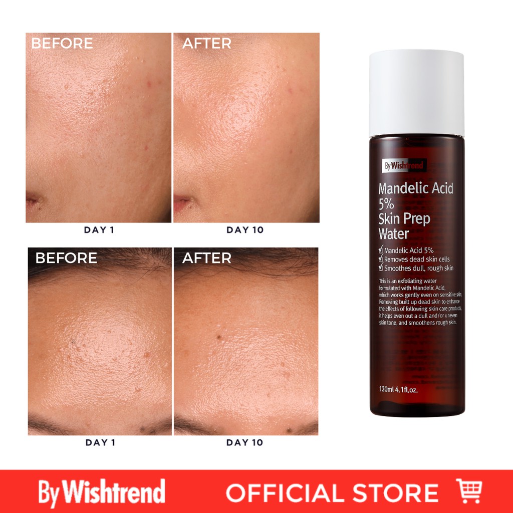 mandelic acid toner wishtrend