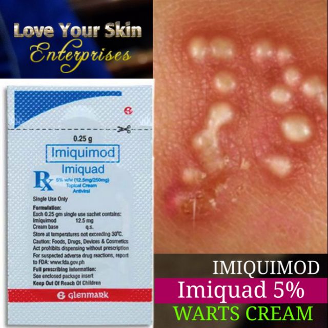 Imiquimod cream 5 where to buy