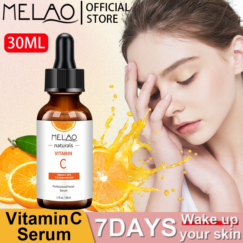 Melao Official Store, Online Shop | Shopee Philippines