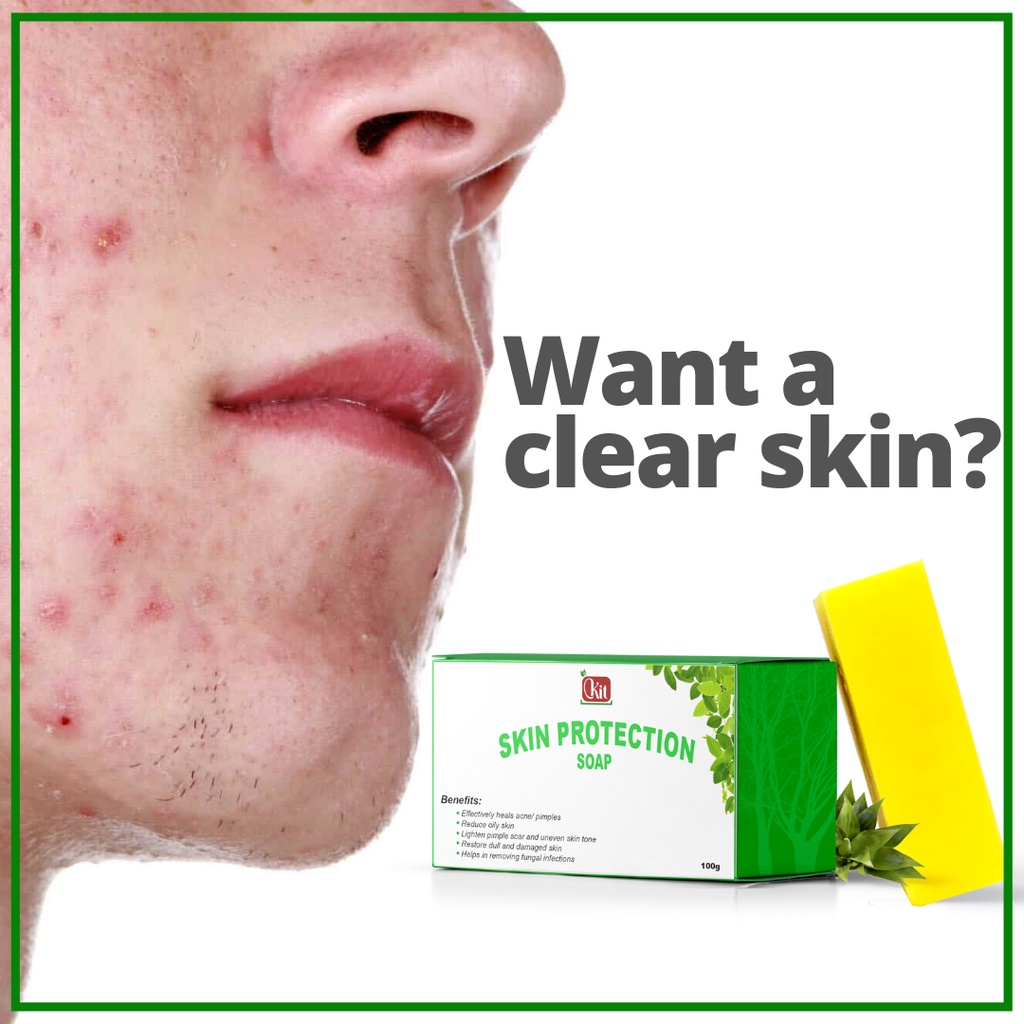 SKIN PROTECTION SOAP Best Pimple / Acne Remover ( pimple eraser /pimple