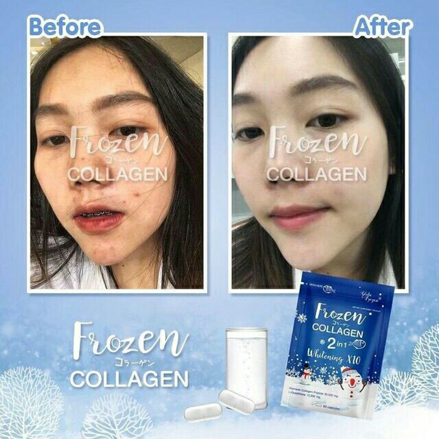 Onhand Lowest Priced - Frozen Collagen Whitening Capsules | Shopee  Philippines