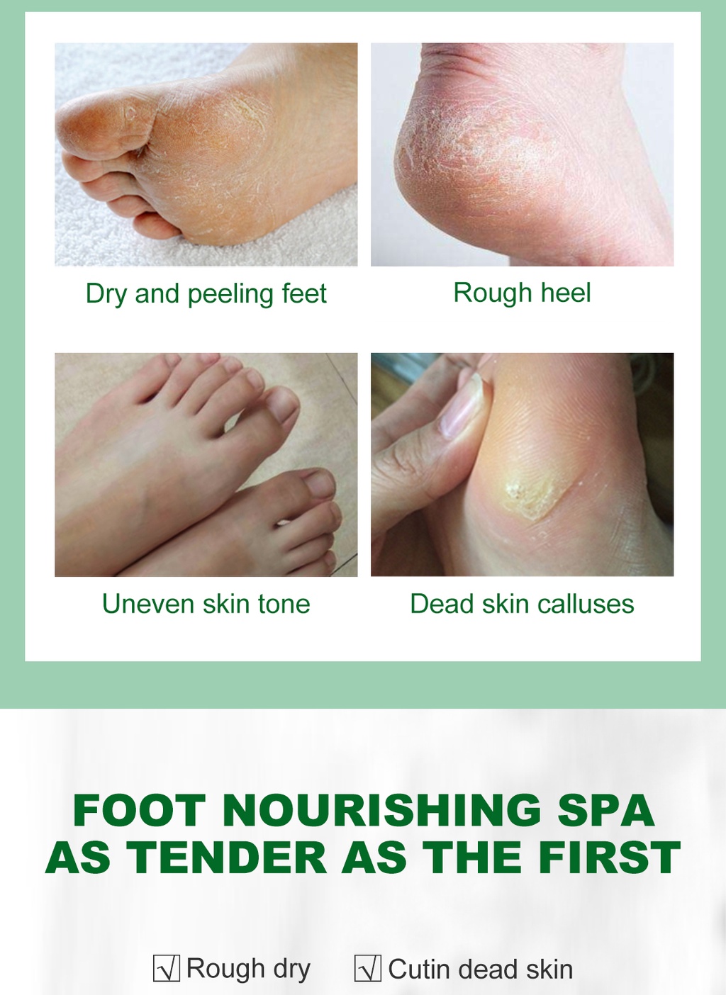 MABREM Foot Treatment Cream Whitening Anti Cracking Moisturizing Foot
