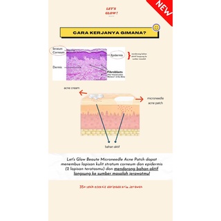 Microneedle ACNE PIMPLE PATCH PREMIUM #6