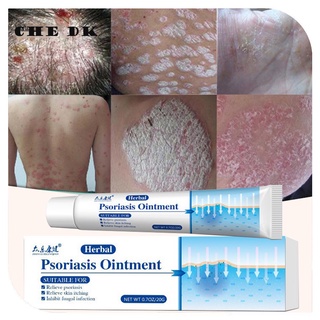 100% Original Authentic Eczema Cream Psoriasis Dermatitis Ointment Health Itching Relief Skin Cream