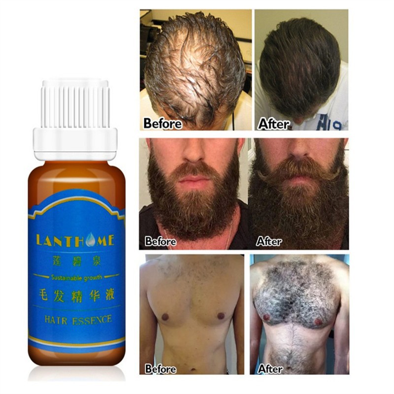 Men Beard Growth Oil 20ml Fast Hair Grow Products Shopee Philippines