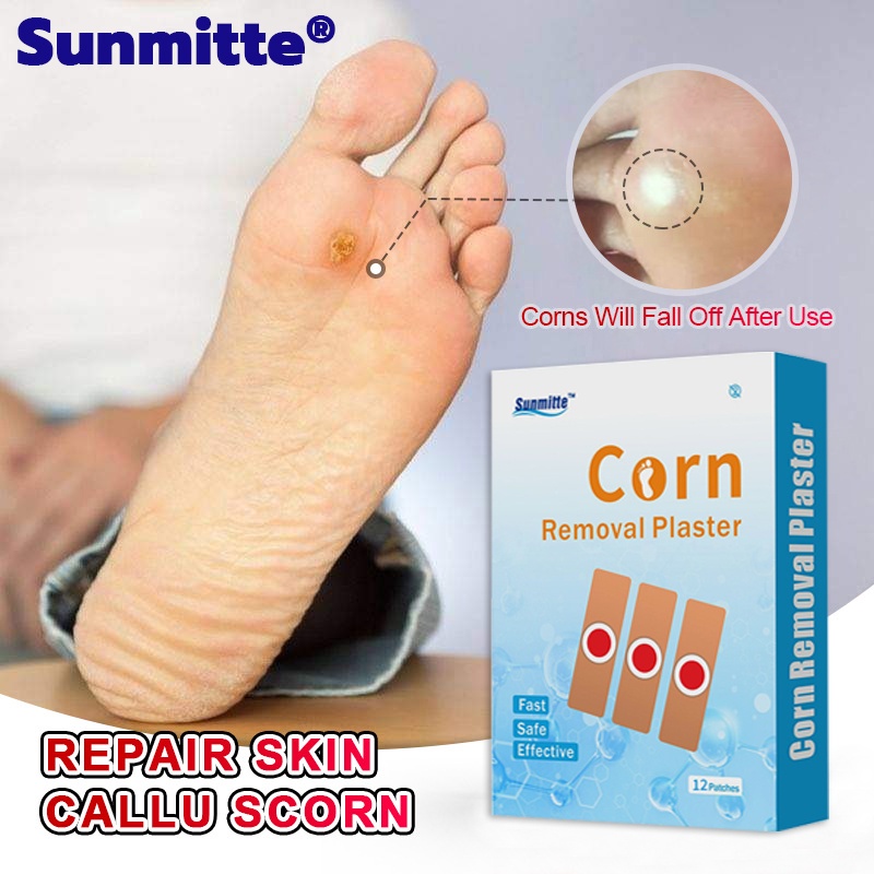 Sunmitte foot corns plantar warts Foot Corn Removal Patch Effectively ...