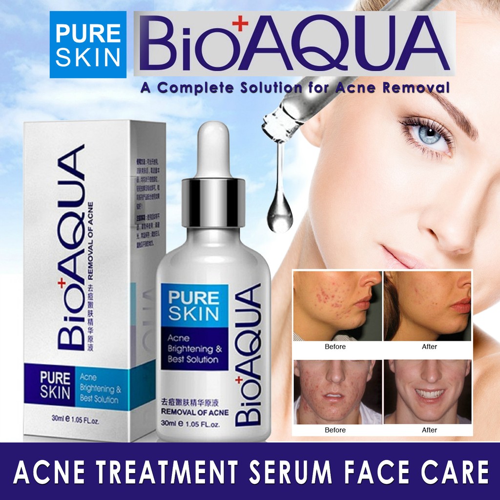 Bioaqua 30ml Acne Serum Face Care Removal Of Acne Scar Shopee