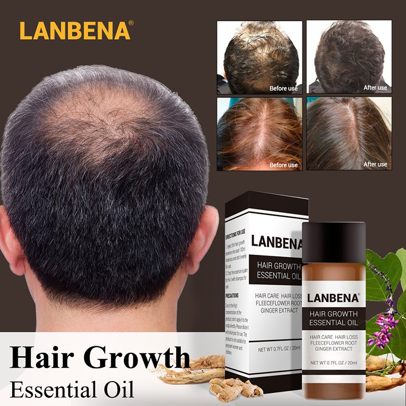 Lanbena Fast Powerful Hair Growth Essence Essential Oil 20ml