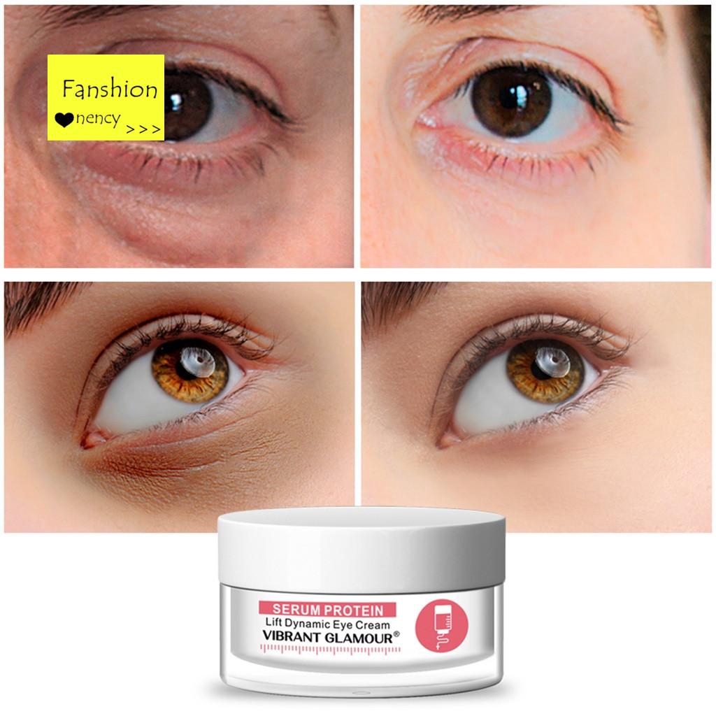 Eye Cream Gel For Dark Circles Puffiness Wrinkles Bags Most Effective AntiAging Shopee