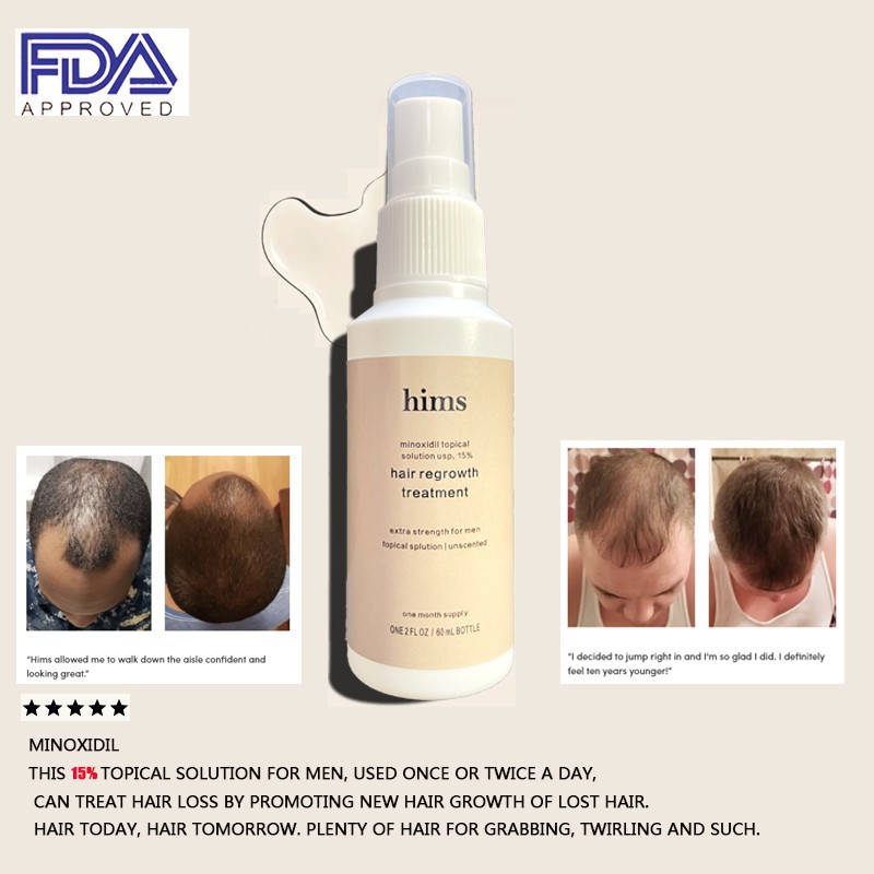hims Minoxidil 15 hair growth spray can effectively prevent hair loss and  promote hair growth, with | Shopee Philippines