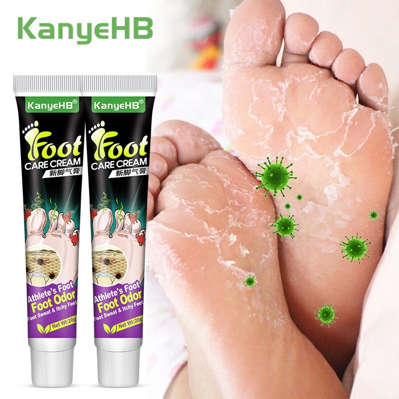 2pcs Antifungal Antiitch Foot Psoriasis Cream Tinea Pedis Ointment
