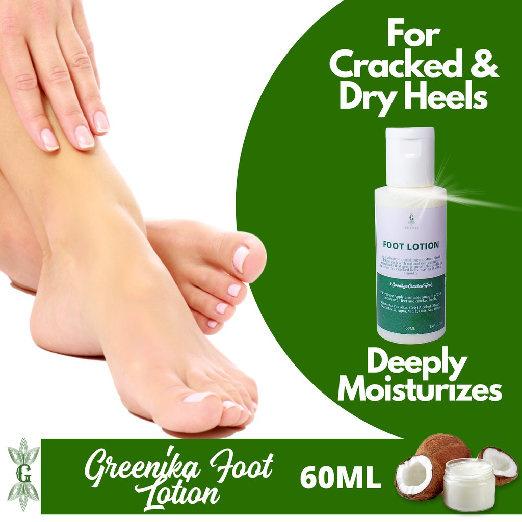 For Cracked Heels Greenika Natural Foot Cream Lotion For Dry Cracked Heels Treatment W Vitamin E Shopee Philippines