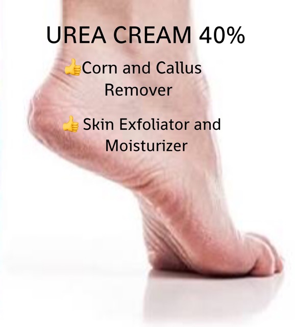 Image result for urea 40 cream ebanel, before after