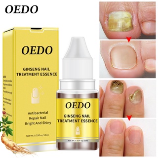 OEDO Antibacterial Nail Treatments Essential Extract Nail Fungus Serum Remove Onychomycosis Toe Nourishing Brighten Hand Foot Skin Care 10ml