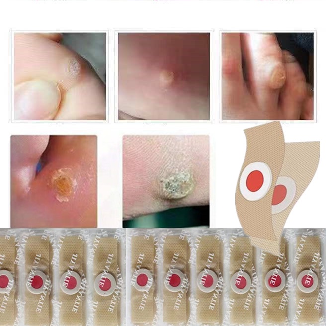 red-brown-spots-on-my-foot-dr-says-its-age-spots-but-i-m-31-r