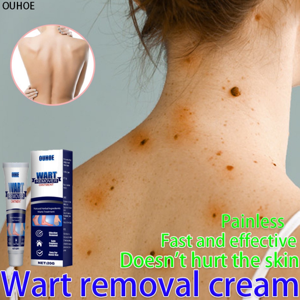 WARTS REMOVER ORIGINAL Warts Remover Corn Treatment Plaster Antibacterial Plantar Warts
