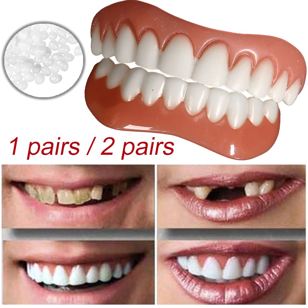 Instant Smile Veneers Cosmetic Teeth Veneer Dentures For Unisex Comfortable Upper And Bottom Veneer Shopee Philippines