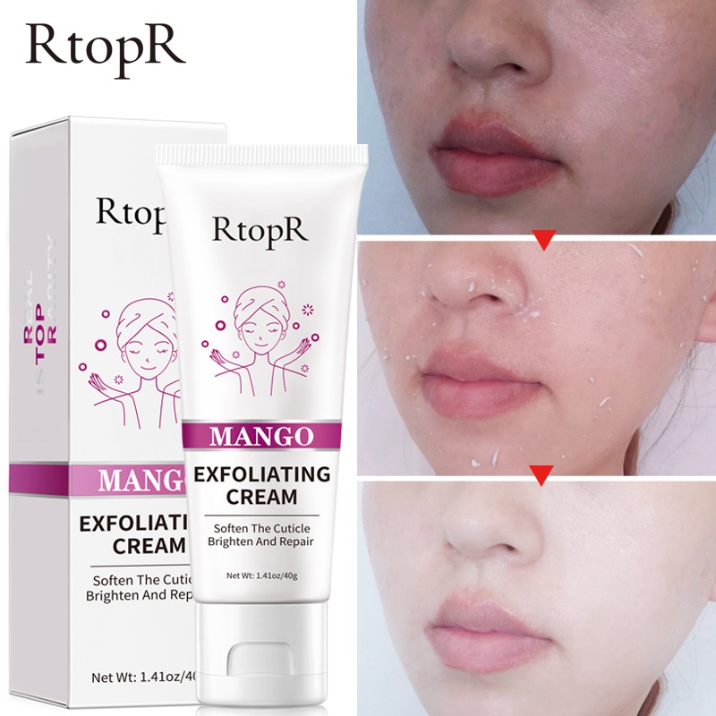 RtopR FDA Skin Care Face Exfoliating Cream Whitening Moisturizer Facial