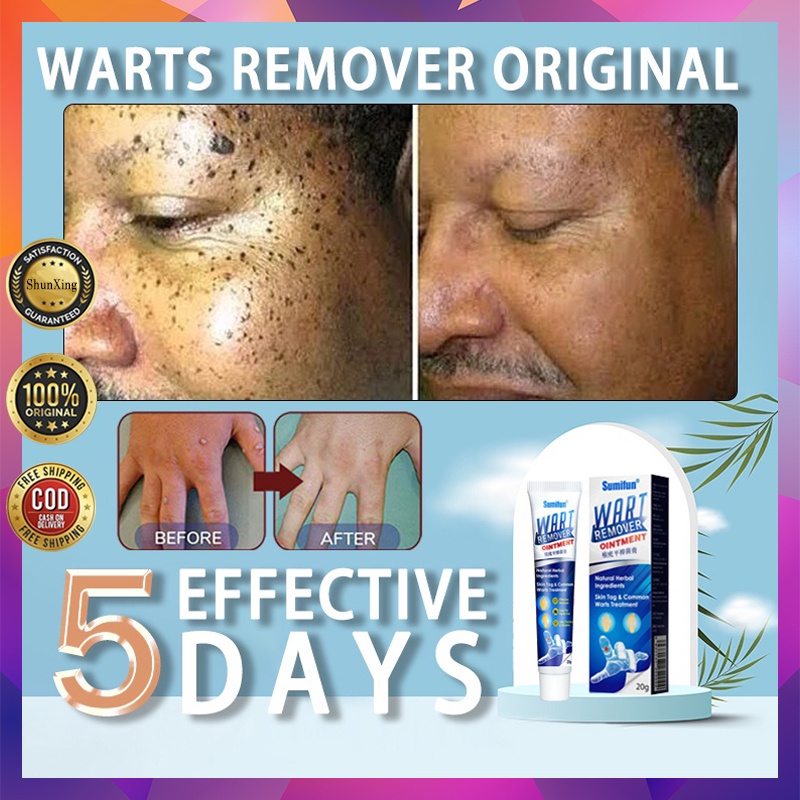 Buy 1 Take 1 Any 2 At 99 Warts Mole Remover Cream Original Skin