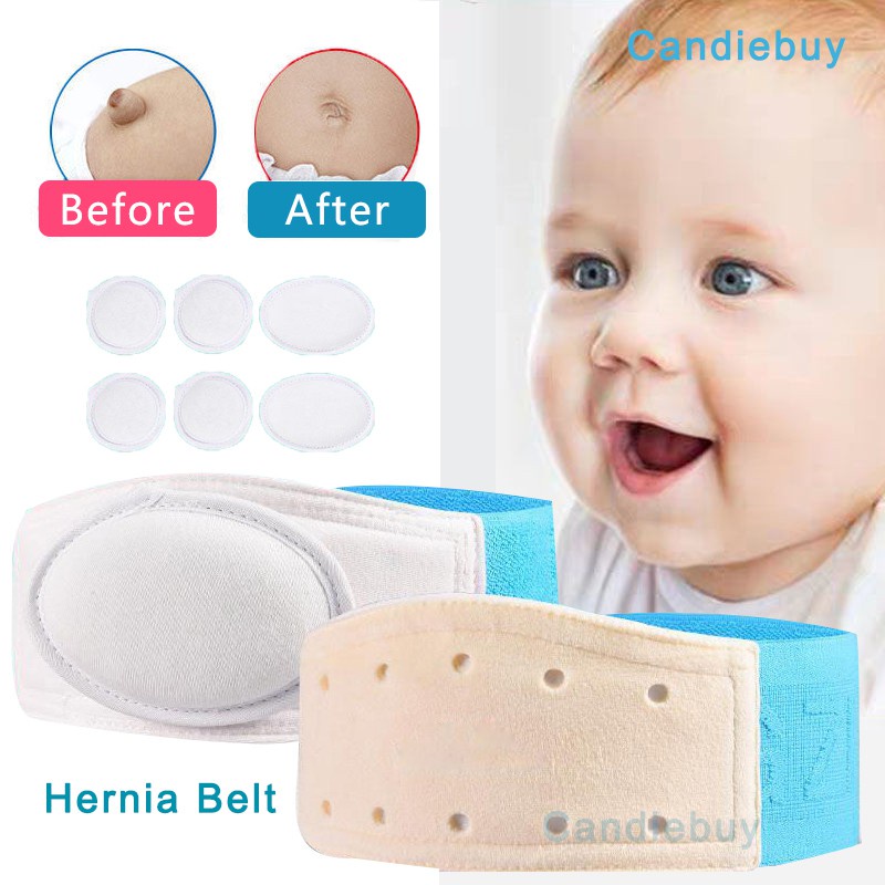 1/2 pcs/Set baby umbilical hernia Hernia Belt Hernia Therapy Treatment