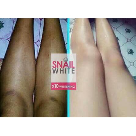 SNAIL WHITE X10 ACNE and WHITENING SOAP 70g