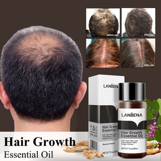 Hair Growth Minoxidil 15% Hair Grower soap for men and women effective ...