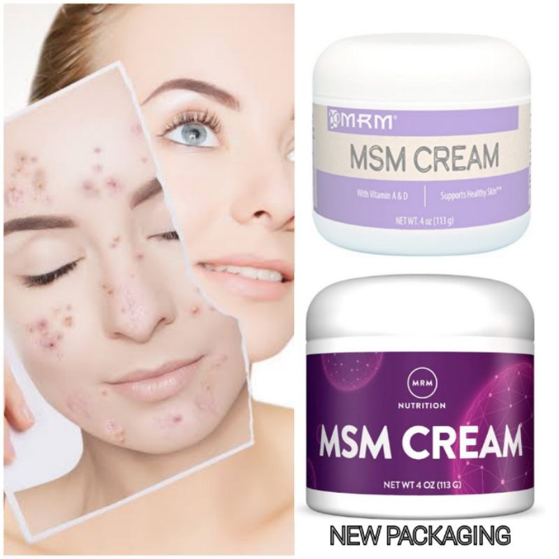 msm cream for acne