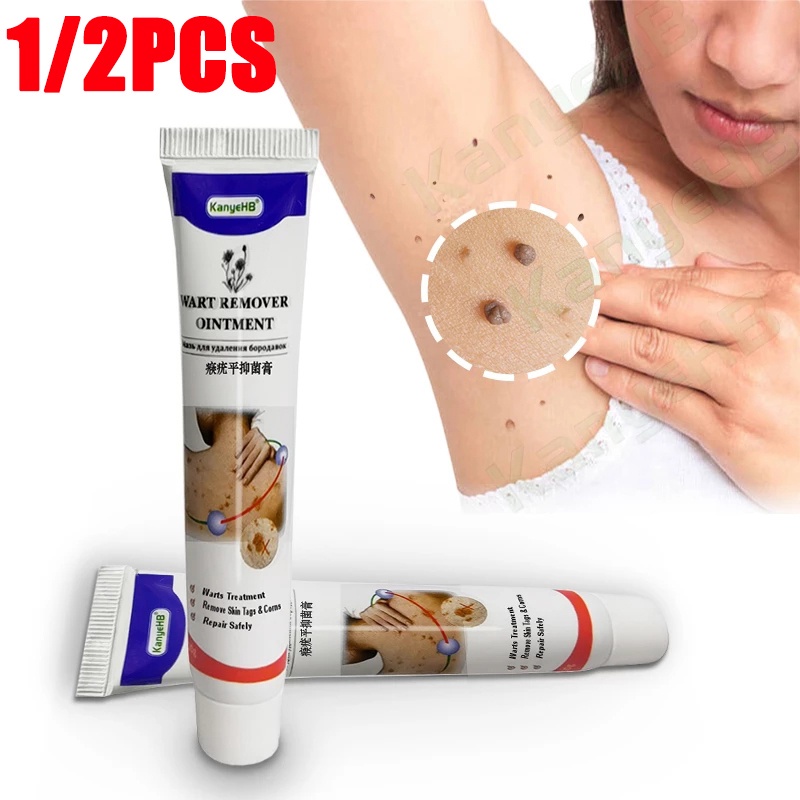 2pcs Skin Tag Remover Cream Warts Remover Cream Wart Treatment Ointment