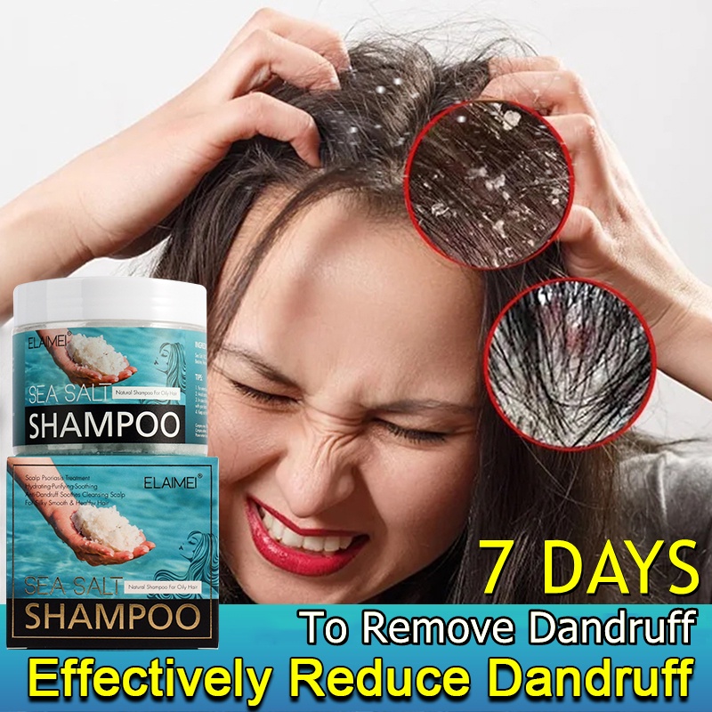 Sea Salt Shampoo Psoriasis Shampoo Anti Dandruff Treatment Shampoo For ...