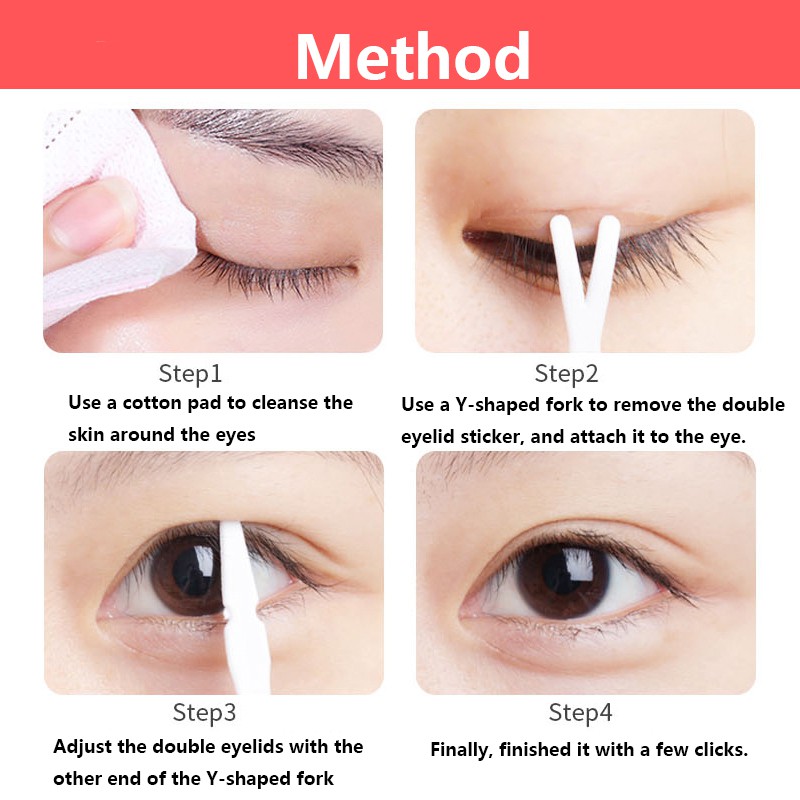 remove double eyelid