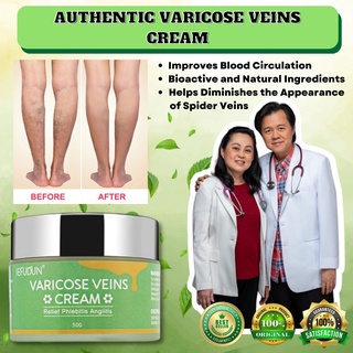 SEFUDUN Varicose Vein Remover Spider Vein Pain Killer Cream ORIGINAL Effective Treatment Cream
